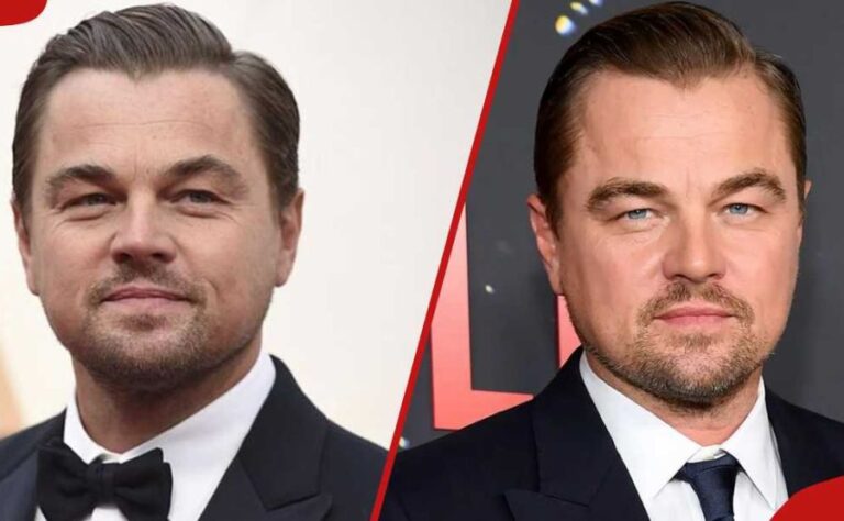 Celebrities with Cleft Lip or Palate: The Unfiltered Truth Nobody Bothered to Write